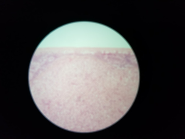 Ovary Slides - Ovary 006 100X